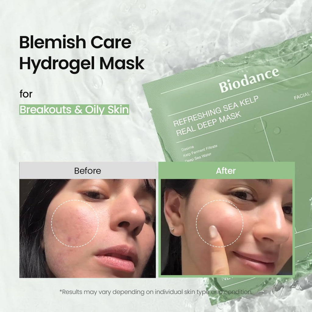 BIODANCE Bio - Collagen Real Deep Mask, Hydrating Overnight Hydrogel Face Mask, Pore Minimizing, Elasticity, Plumping, Travel Essentials & Self Care Gifts for Women, Korean Skin Care | 1.19oz(34g) x 4ea - Dealqueen
