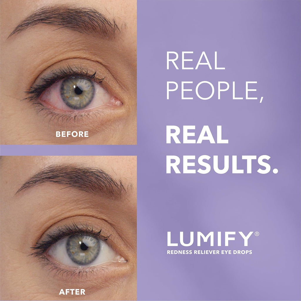 LUMIFY Eye Drops for Red Eyes, Redness Reliever for Brighter Looking Eyes, Works in 1 Minute & Lasts Up to 8 Hours, Eye Drops, 0.08 Fl Oz (2.5 mL) - Dealqueen