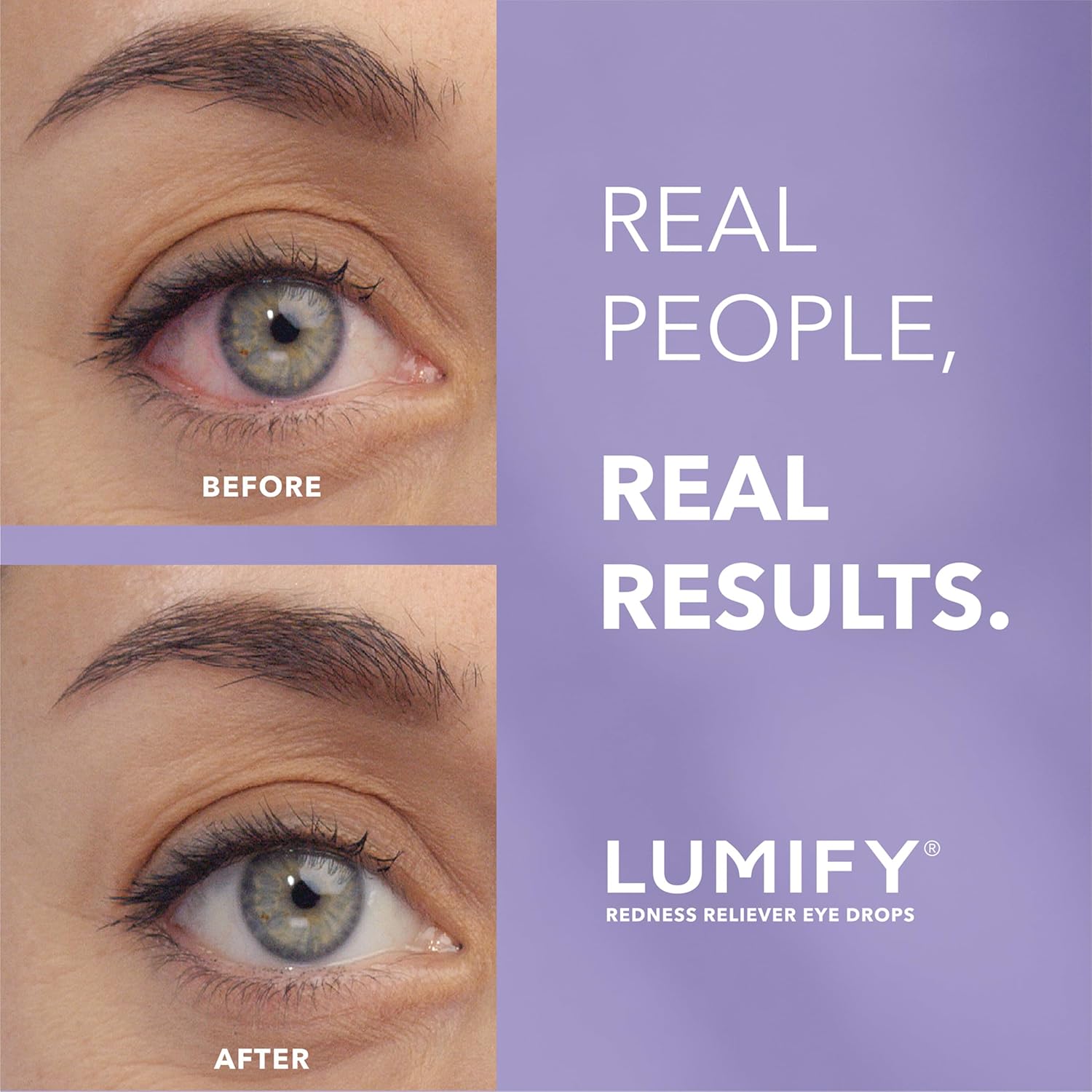LUMIFY Eye Drops for Red Eyes, Redness Reliever for Brighter Looking Eyes, Works in 1 Minute & Lasts Up to 8 Hours, Eye Drops, 0.08 Fl Oz (2.5 mL) - Dealqueen